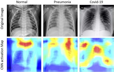 COVID-19 Detection from Chest X-Ray Image using Deep Convolutional Neural Network